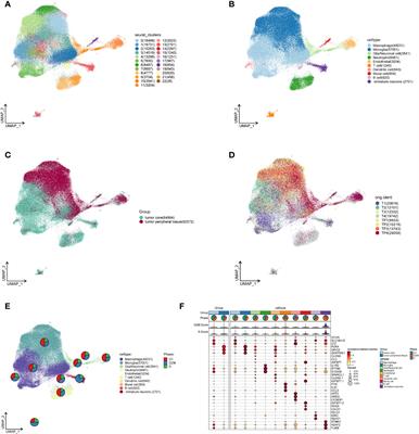 Examining the function of macrophage oxidative stress response and immune system in glioblastoma multiforme through analysis of single-cell transcriptomics